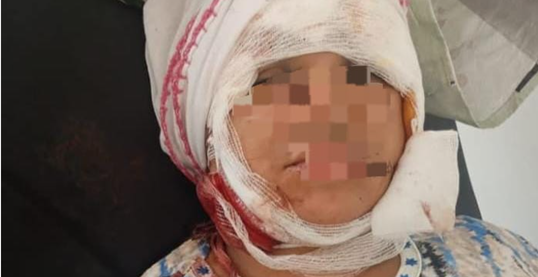 محاولة ذبح سيدة على يد زوجها بالقنيطرة تكشف سنوات من العنف الأسري 1 Capture decran 2026 07 16 205403
