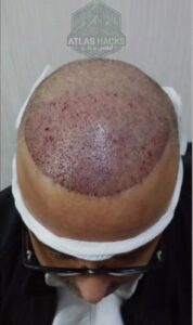 من يكون جيراندو؟ تسريبات أطلس هاكس تفتح الصندوق الأسود 2 WhatsApp Image 2026 08 22 at 12.48.36 1